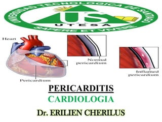 PERICARDITIS
CARDIOLOGIA
Dr. ERILIEN CHERILUS

 