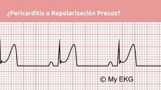 ¿Pericarditis o Repolarización Precoz?
 