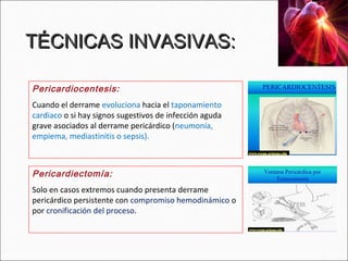 TÉCNICAS INVASIVAS:

Pericardiocentesis:
Cuando el derrame evoluciona hacia el taponamiento
cardiaco o si hay signos sugestivos de infección aguda
grave asociados al derrame pericárdico (neumonía,
empiema, mediastinitis o sepsis).



Pericardiectomía:
Solo en casos extremos cuando presenta derrame
pericárdico persistente con compromiso hemodinámico o
por cronificación del proceso.
 