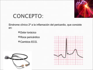Sindrome clínico 2º a la inflamación del pericardio, que consiste
en:
        Dolor torácico
        Roce pericárdico
        Cambios ECG.
 