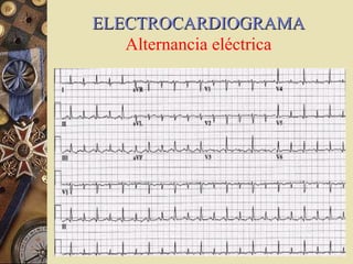 ELECTROCARDIOGRAMAELECTROCARDIOGRAMA
Alternancia eléctrica
 