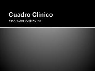 PERICARDITIS CONSTRICTIVA
 