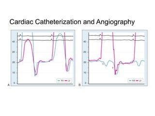 Cardiac Catheterization and Angiography
 