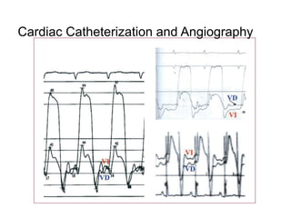 Cardiac Catheterization and Angiography
 