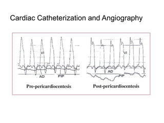 Cardiac Catheterization and Angiography
 