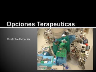 Constrictive Pericarditis
 