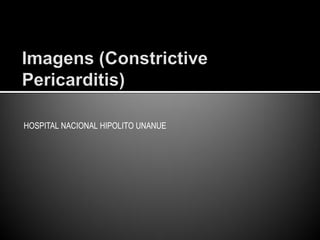 HOSPITAL NACIONAL HIPOLITO UNANUE
 