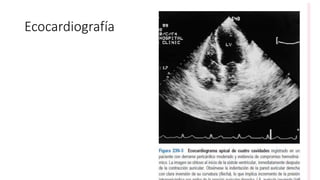 Ecocardiografía
 