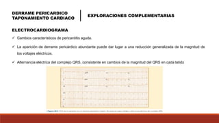 pERICARDITIS EXPO FINAL RELOADED.pptx
