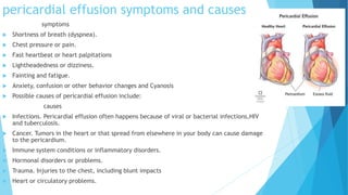 pericardial effusion symptoms and causes
symptoms
 Shortness of breath (dyspnea).
 Chest pressure or pain.
 Fast heartbeat or heart palpitations
 Lightheadedness or dizziness.
 Fainting and fatigue.
 Anxiety, confusion or other behavior changes and Cyanosis
 Possible causes of pericardial effusion include:
causes
 Infections. Pericardial effusion often happens because of viral or bacterial infections,HIV
and tuberculosis.
 Cancer. Tumors in the heart or that spread from elsewhere in your body can cause damage
to the pericardium.
 Immune system conditions or inflammatory disorders.
 Hormonal disorders or problems.
 Trauma. Injuries to the chest, including blunt impacts
 Heart or circulatory problems.
 