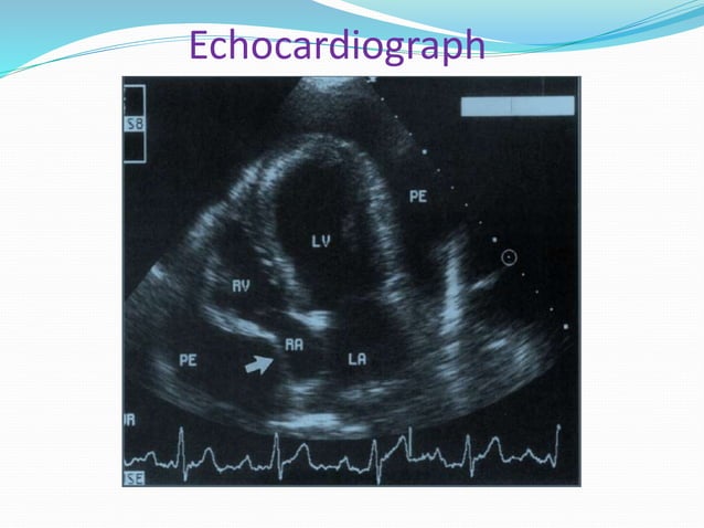 Pericarditis in animals | PPT