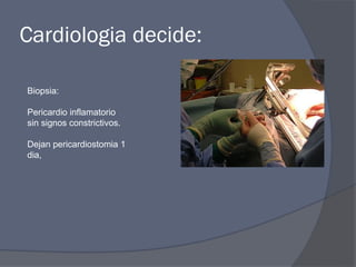 Cardiologia decide:

Biopsia:

Pericardio inflamatorio
sin signos constrictivos.

Dejan pericardiostomia 1
dia,
 