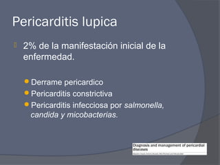 Pericarditis lupica
   2% de la manifestación inicial de la
    enfermedad.

    Derrame pericardico
    Pericarditis constrictiva
    Pericarditis infecciosa por salmonella,
     candida y micobacterias.
 