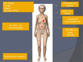 PA: 158/60                Orientada en 3
FC 96 ‘                       esferas
Afebril
Sat 95% FR 22             No IY, no
                           masas

                               Crepitos BI
                            Hipoventilada BD
     Sin dolor , sin
    visceromegalias
                            RsCsRs no
                              soplo
                             No frote




Insuficiencia Venosa II
 