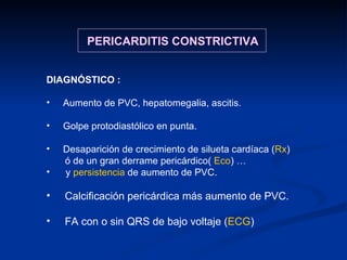 DIAGNÓSTICO : Aumento de PVC, hepatomegalia, ascitis. Golpe protodiastólico en punta. Desaparición de crecimiento de silueta cardíaca ( Rx ) ó de un gran derrame pericárdico(  Eco ) … y  persistencia  de aumento de PVC. Calcificación pericárdica más aumento de PVC. FA con o sin QRS de bajo voltaje ( ECG ) PERICARDITIS CONSTRICTIVA 