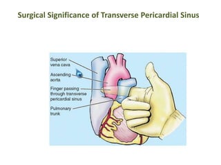 Surgical Significance of Transverse Pericardial Sinus
 