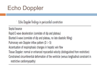 Echo Doppler
 