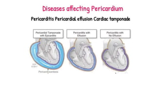 Pericardium.pptx