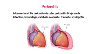 Pericardium.pptx
