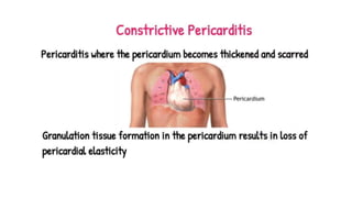 Pericardium.pptx