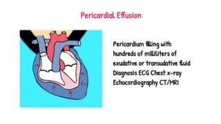 Pericardium.pptx