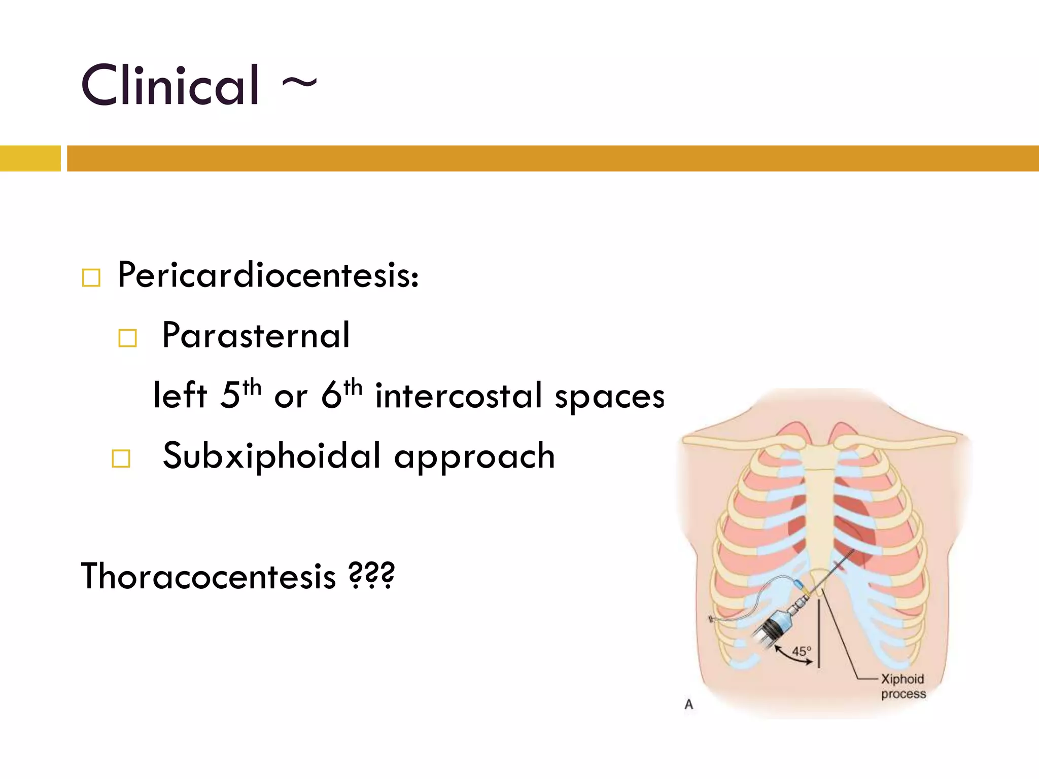 Clinical ~
Pericardiocentesis:
Parasternal
left 5th or 6th intercostal spaces.
Subxiphoidal approach
Thoracocentesis ???