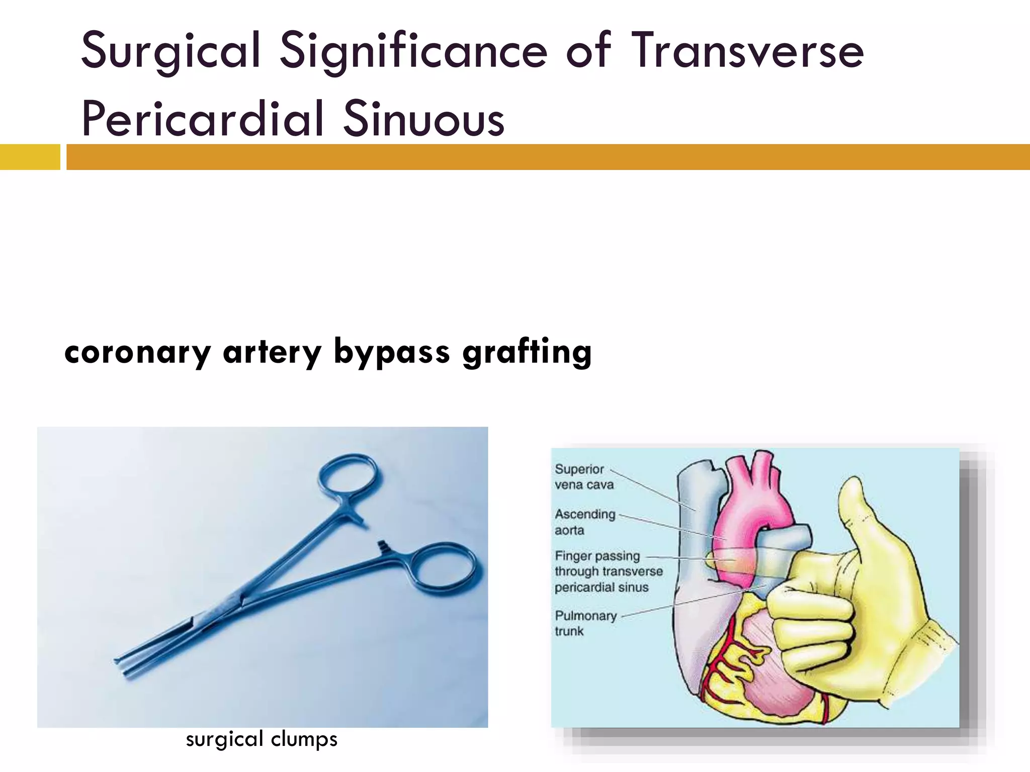 Surgical Significance of Transverse
Pericardial Sinuous
coronary artery bypass grafting
surgical clumps