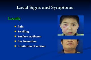 Local Signs and Symptoms  Pain  Swelling  Surface erythema  Pus formation  Limitation of motion Locally 