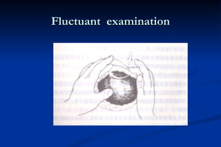Fluctuant  examination 