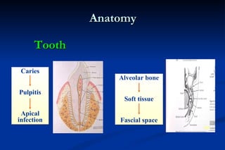 Anatomy Alveolar bone Soft tissue Fascial space Tooth Caries Pulpitis Apical infection 
