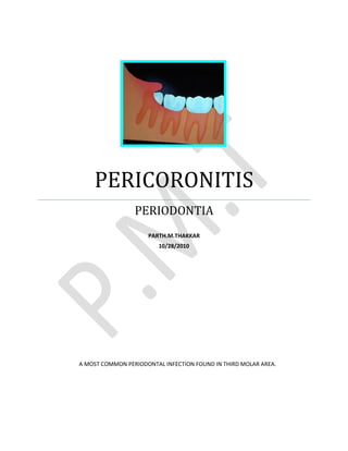 PERICORONITIS
                 PERIODONTIA
                     PARTH.M.THAKKAR
                         10/28/2010




A MOST COMMON PERIODONTAL INFECTION FOUND IN THIRD MOLAR AREA.
 