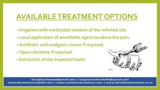 AVAILABLETREATMENT OPTIONS
• Irrigation with medicated solution of the infected site.
• Local application of anesthetic agent to educe the pain.
• Antibiotic and analgesic course if required.
• Operculectomy if required.
• Extraction of the impacted tooth
 