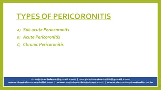 TYPES OF PERICORONITIS
A) Sub acute Periocoronits
B) Acute Pericoronitis
C) Chronic Pericoronitis
 
