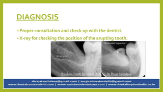 DIAGNOSIS
• Proper consultation and check up with the dentist.
• X-ray for checking the position of the erupting tooth.
 