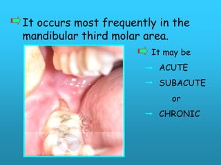 It occurs most frequently in the
mandibular third molar area.
                        It may be
                          ACUTE
                          SUBACUTE
                            or
                          CHRONIC
 