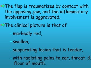 The flap is traumatizes by contact with
the opposing jaw, and the inflammatory
involvement is aggravated.
The clinical picture is that of
    markedly red,
    swollen,
    suppurating lesion that is tender,
    with radiating pains to ear, throat, &
    floor of mouth.
 