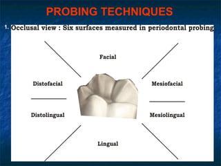 PROBING TECHNIQUES
1.
 