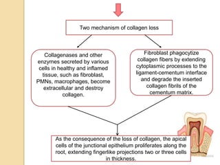 Two mechanism of collagen loss
Collagenases and other
enzymes secreted by various
cells in healthy and inflamed
tissue, such as fibroblast,
PMNs, macrophages, become
extracellular and destroy
collagen.
Fibroblast phagocytize
collagen fibers by extending
cytoplasmic processes to the
ligament-cementum interface
and degrade the inserted
collagen fibrils of the
cementum matrix.
As the consequence of the loss of collagen, the apical
cells of the junctional epithelium proliferates along the
root, extending fingerlike projections two or three cells
in thickness.
 