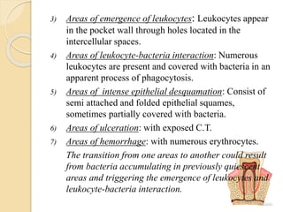 3) Areas of emergence of leukocytes: Leukocytes appear
in the pocket wall through holes located in the
intercellular spaces.
4) Areas of leukocyte-bacteria interaction: Numerous
leukocytes are present and covered with bacteria in an
apparent process of phagocytosis.
5) Areas of intense epithelial desquamation: Consist of
semi attached and folded epithelial squames,
sometimes partially covered with bacteria.
6) Areas of ulceration: with exposed C.T.
7) Areas of hemorrhage: with numerous erythrocytes.
The transition from one areas to another could result
from bacteria accumulating in previously quiescent
areas and triggering the emergence of leukocytes and
leukocyte-bacteria interaction.
 