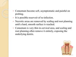  Cementum become soft, asymptomatic and painful on
probing.
 It is possible reservoir of re-infection.
 Necrotic areas are removed by scaling and root planning
until a hard, smooth surface is reached.
 Cementum is very thin in cervical area, and scaling and
root planning often remove it entirely, exposing the
underlying dentin.
 