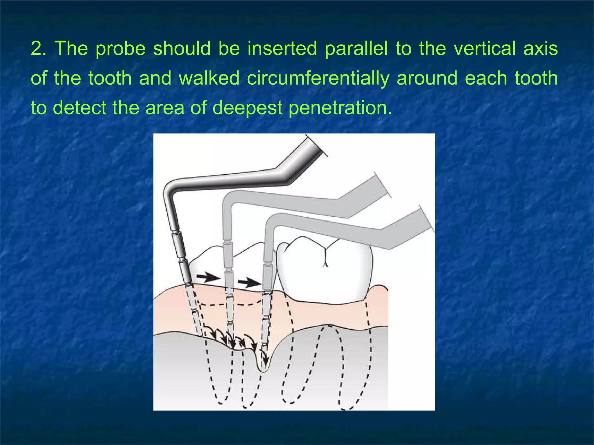 2. The probe should be inserted parallel to the vertical axis of the tooth and walked circumferentially around each tooth to detect the area of deepest penetration. 