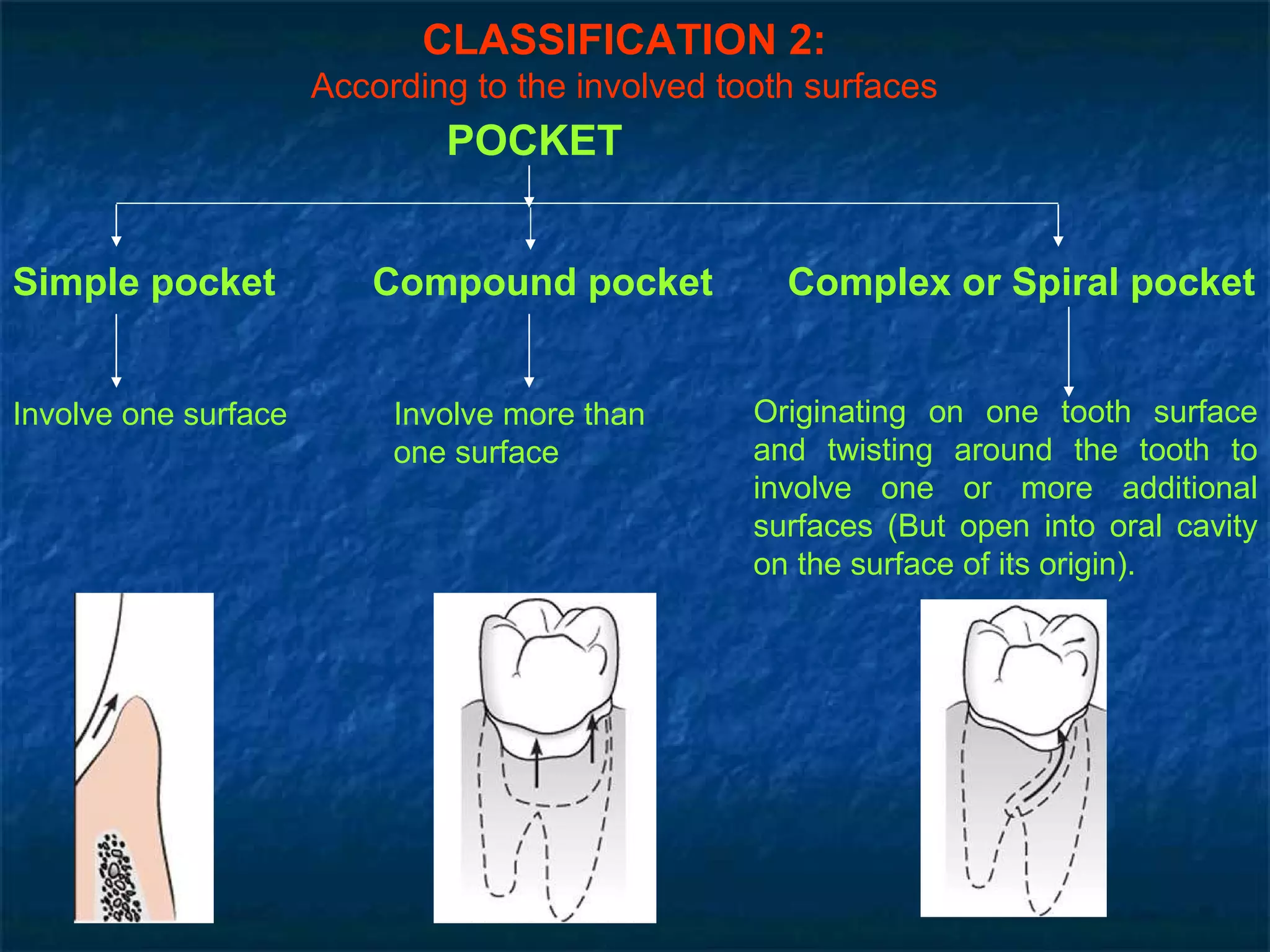 CLASSIFICATION 2: According to the involved tooth surfaces Involve one surface  Involve more than one surface  Originating on one tooth surface and twisting around the tooth to involve one or more additional surfaces (But open into oral cavity on the surface of its origin).  POCKET Simple pocket Compound pocket Complex or Spiral pocket 