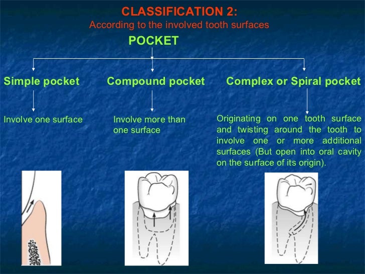 Peridontal pocket