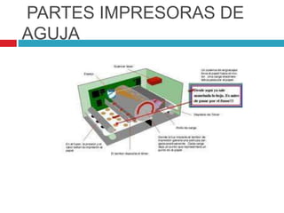 PARTES IMPRESORAS DE
AGUJA
 