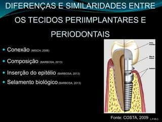DIFERENÇAS E SIMILARIDADES ENTRE
OS TECIDOS PERIIMPLANTARES E
PERIODONTAIS
 Conexão (MISCH, 2006)
 Composição (BARBOSA, 2013)
 Inserção do epitélio (BARBOSA, 2013)
 Selamento biológico(BARBOSA, 2013)
Fonte: COSTA, 2009 L.P.M.C.
 
