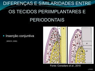 DIFERENÇAS E SIMILARIDADES ENTRE
OS TECIDOS PERIIMPLANTARES E
PERIODONTAIS
 Inserção conjuntiva
(MISCH, 2006)
Fonte: Consolaro et al., 2010
L.P.M.C.
 