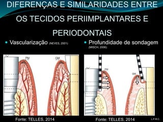 DIFERENÇAS E SIMILARIDADES ENTRE
OS TECIDOS PERIIMPLANTARES E
PERIODONTAIS
 Vascularização (NEVES, 2001)  Profundidade de sondagem
(MISCH, 2006)
Fonte: TELLES, 2014 L.P.M.C.Fonte: TELLES, 2014
 