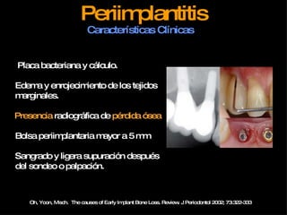 Periimplantitis Características Clínicas   Oh, Yoon, Misch.  The causes of Early Implant Bone Loss. Review. J Periodontol 2002; 73:322-333   Placa bacteriana y cálculo. Edema y enrojecimiento de los tejidos marginales. Presencia  radiográfica de  pérdida ósea Bolsa periimplantaria mayor a 5 mm Sangrado y ligera supuración después del sondeo o palpación. 