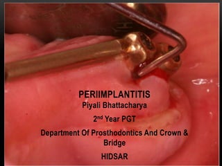 Piyali Bhattacharya
2nd Year PGT
Department Of Prosthodontics And Crown &
Bridge
HIDSAR
PERIIMPLANTITIS
 