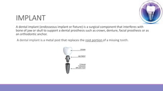 IMPLANT
A dental implant (endosseous implant or fixture) is a surgical component that interferes with
bone of jaw or skull to support a dental prosthesis such as crown, denture, facial prosthesis or as
an orthodontic anchor.
A dental implant is a metal post that replaces the root portion of a missing tooth.
 